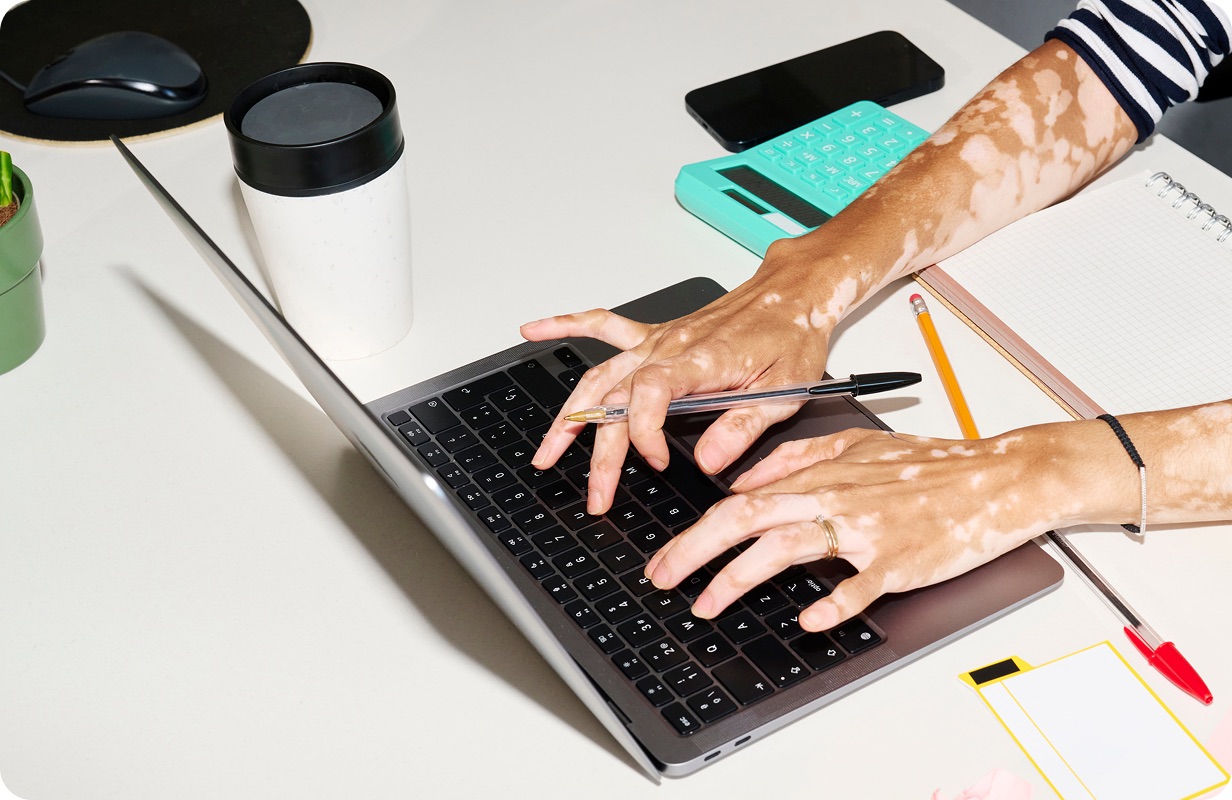 Pay vendors the way they want
